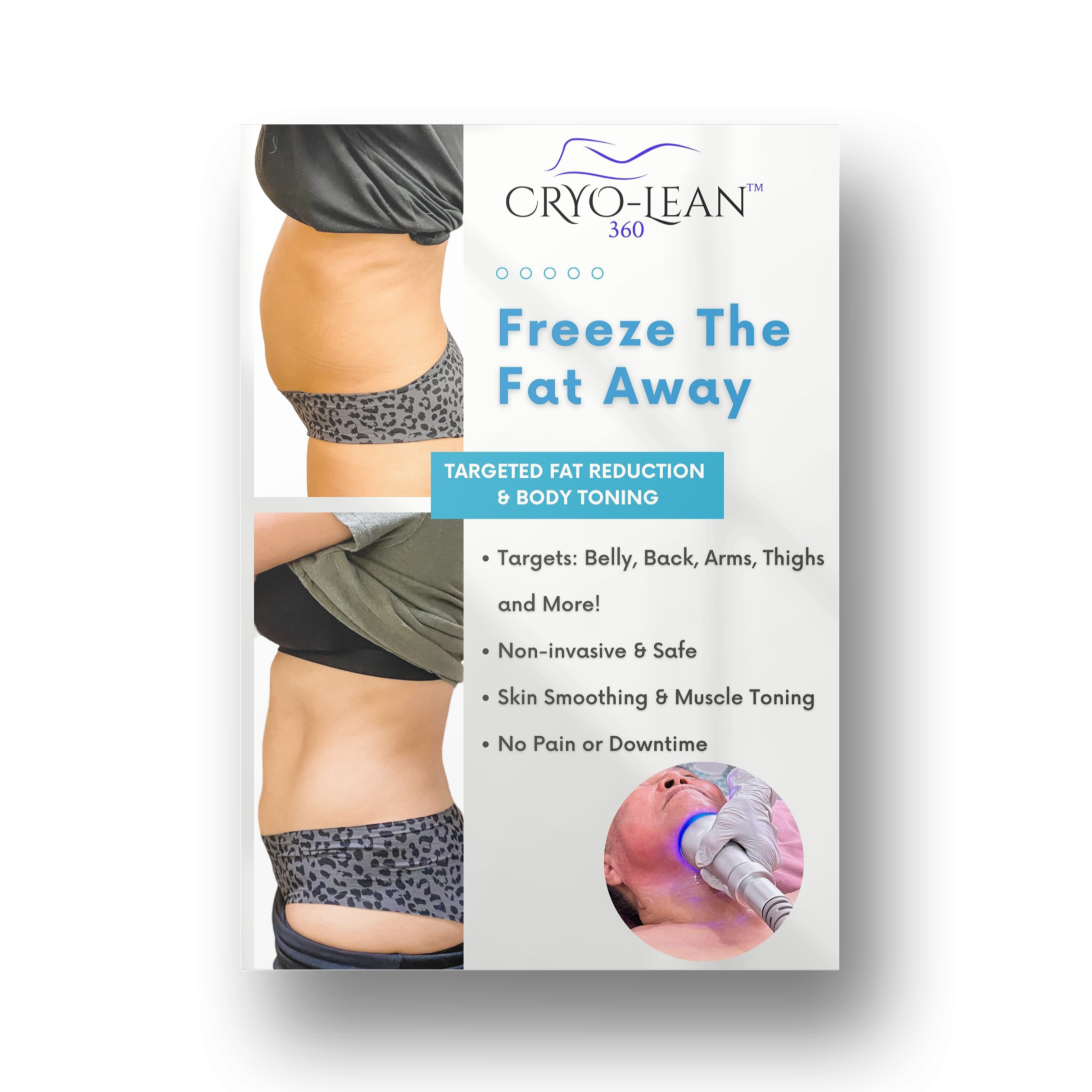 Cryo-Lean 360 Poster