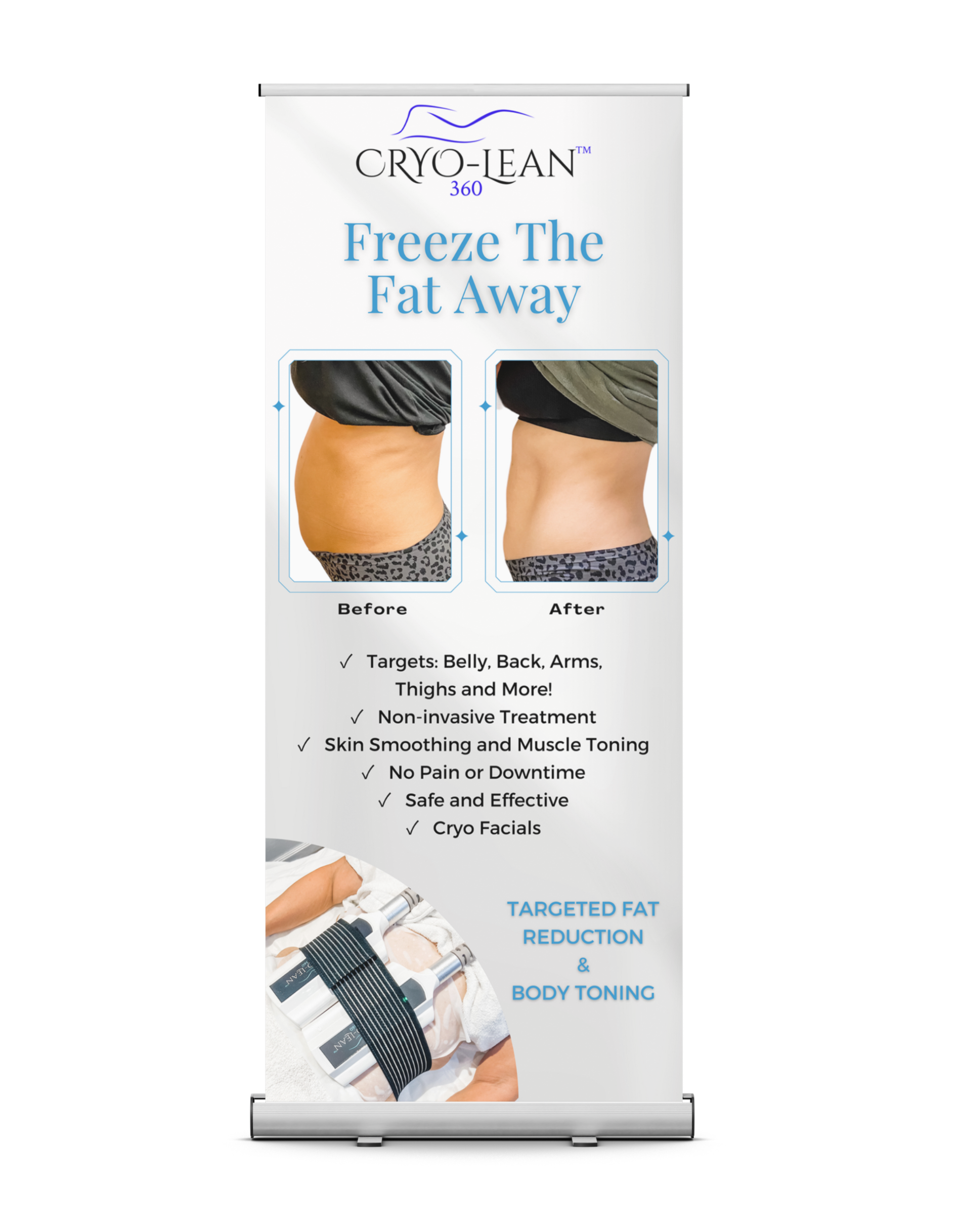 Cryo-Lean 360 Roll-up Floor Standing Banner