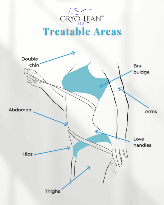 Treatable areas